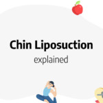 chin-liposuction