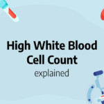 High white blood cell count