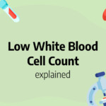 Low white blood cell count