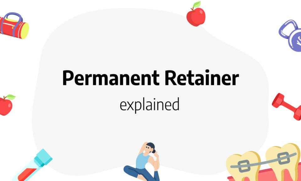 permanent retainer