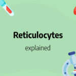 reticulocytes