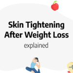 how to tighten skin after weight loss naturally