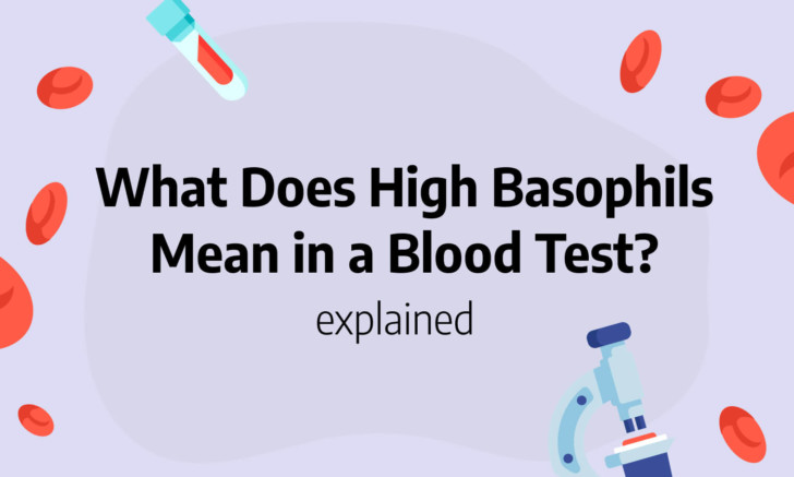 what-does-high-basophils-mean-in-a-blood-test