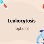 leukocytosis