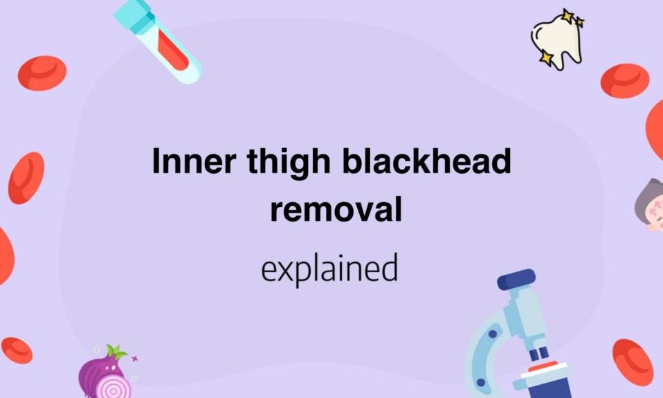 Inner thigh blackhead removal