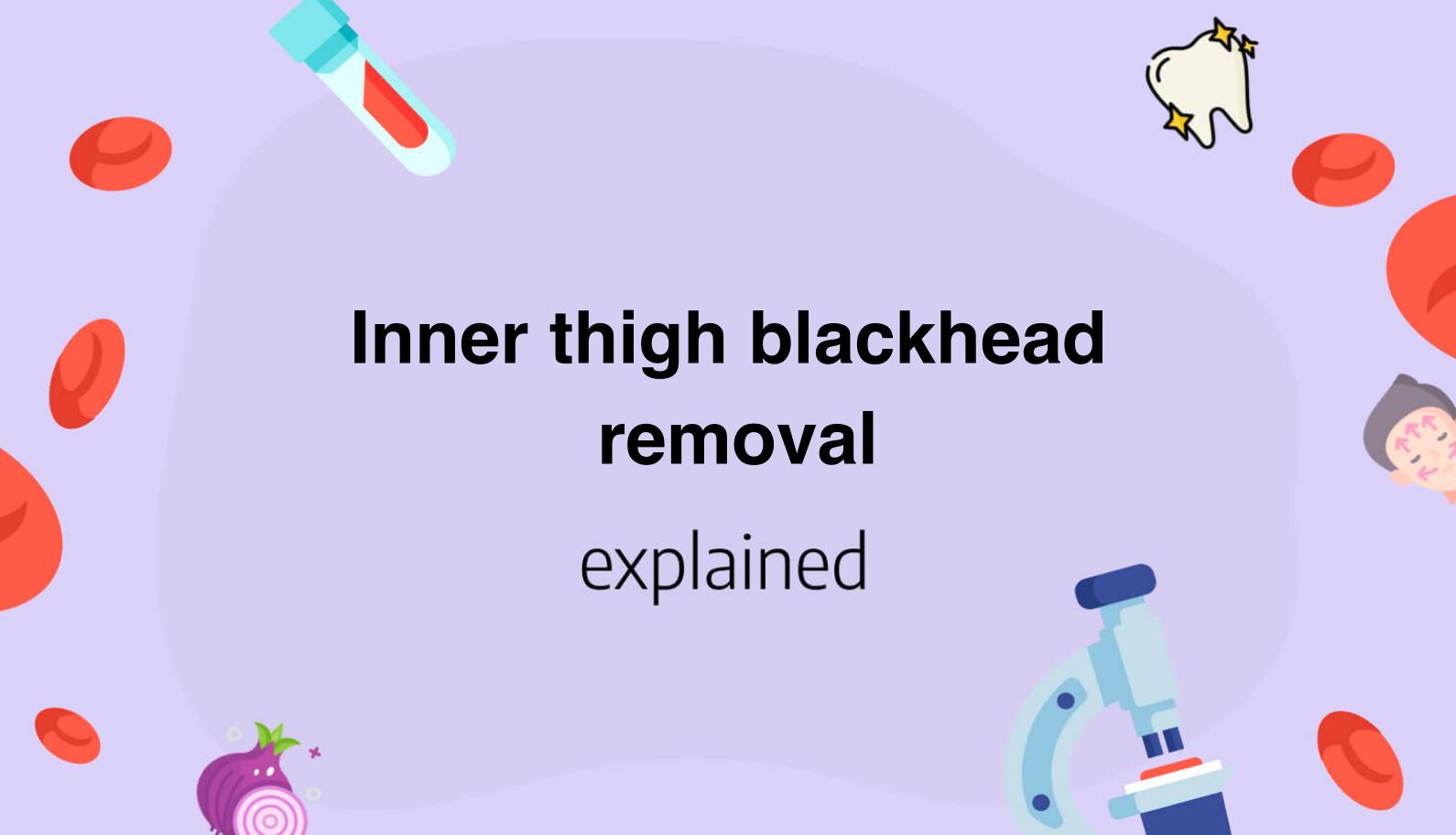 Inner thigh blackhead removal
