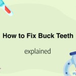 How to Fix Buck Teeth