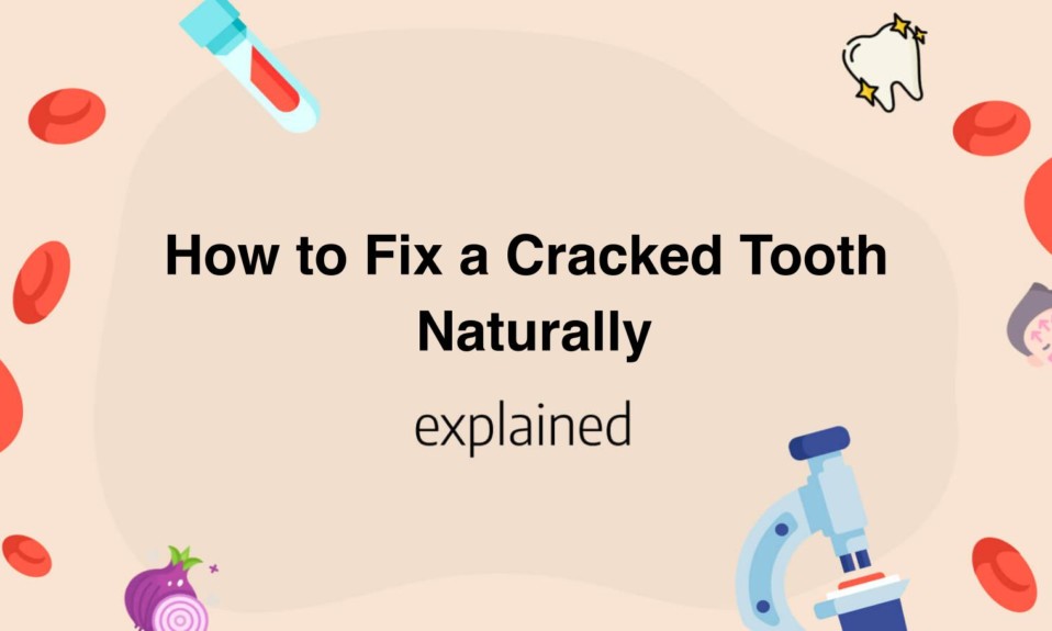 How to Fix a Cracked Tooth Naturally