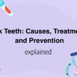 Buck Teeth: Causes, Treatments, and Prevention