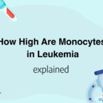 How High Are Monocytes in Leukemia