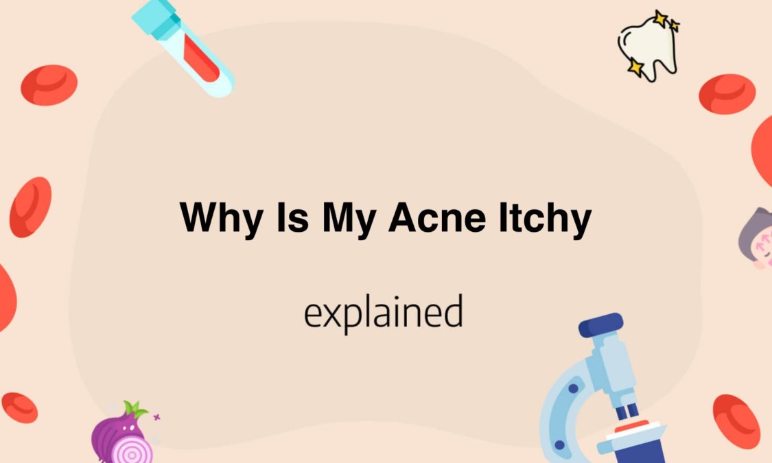 Nutrafol Side Effects: What to Expect