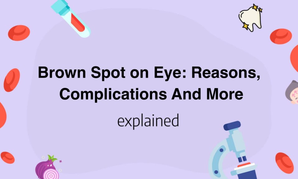 Brown Spot on Eye: Reasons, Complications And More