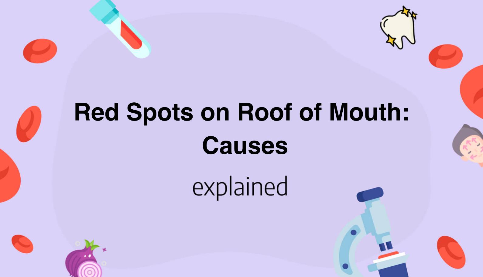 red-spots-on-roof-of-mouth-causes