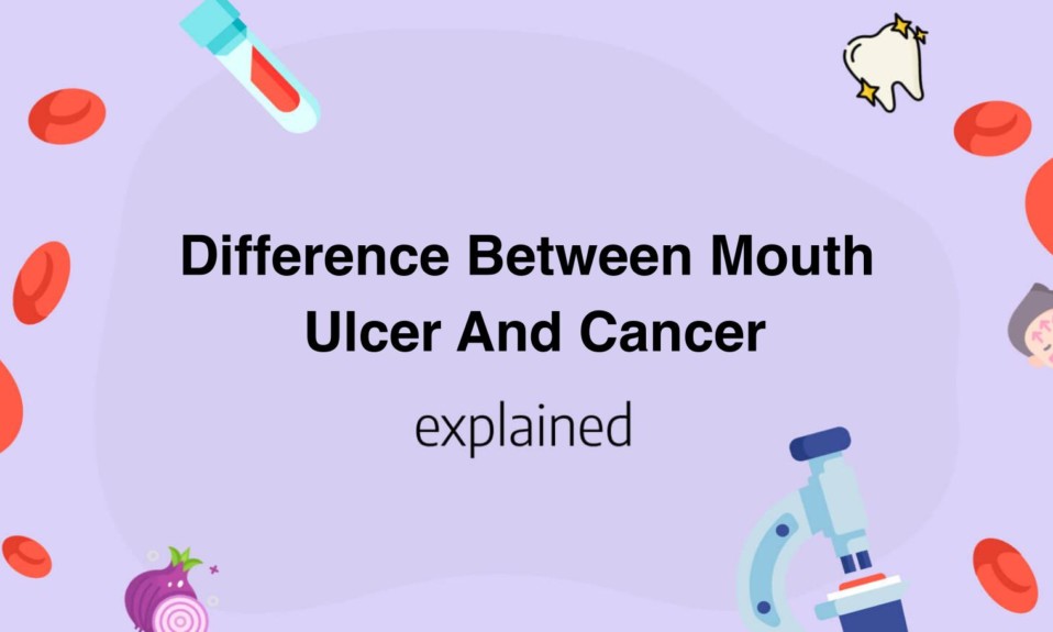 Difference Between Mouth Ulcer And Cancer