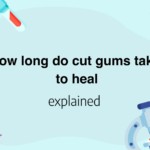 How long do cut gums take to heal