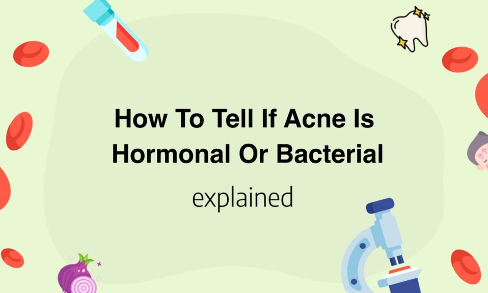 How To Tell If Acne Is Hormonal Or Bacterial