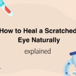 How to Heal a Scratched Eye Naturally
