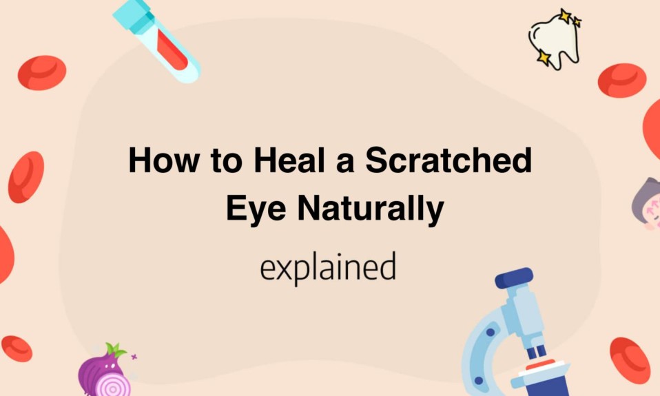 How to Heal a Scratched Eye Naturally