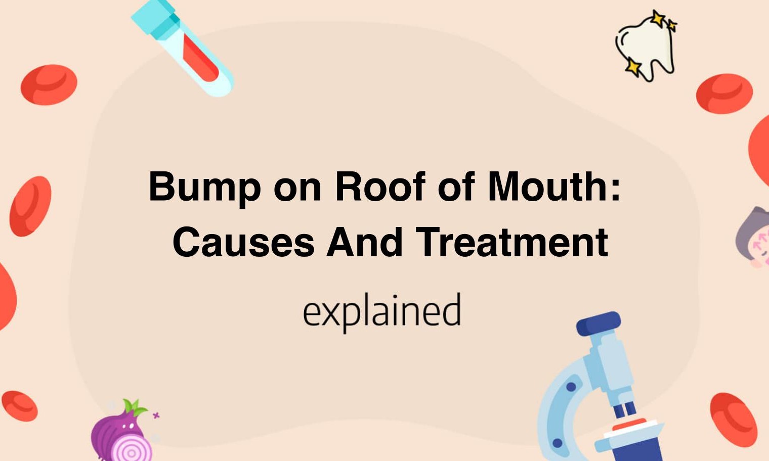 bump-on-roof-of-mouth-causes-and-treatment