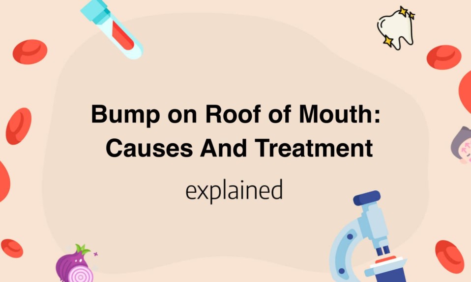 Bump on Roof of Mouth: Causes And Treatment