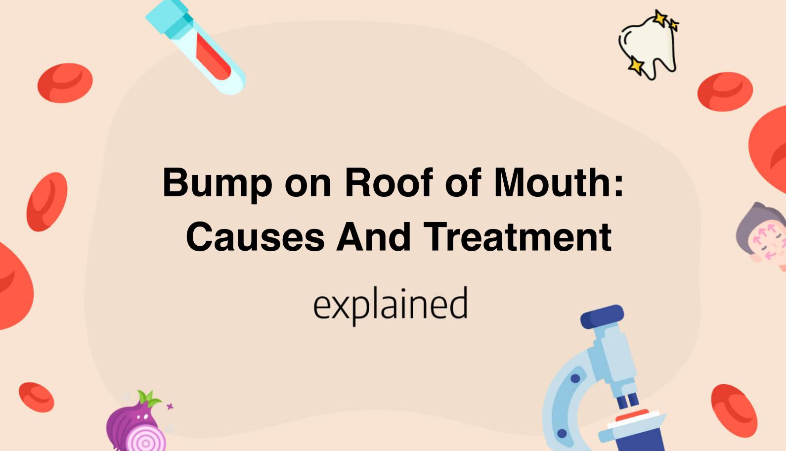 bump-on-roof-of-mouth-causes-and-treatment