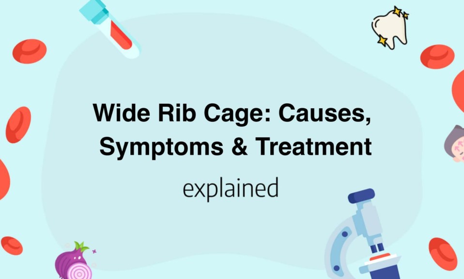 Wide Rib Cage: Causes, Symptoms & Treatment
