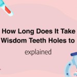 How Long Does It Take For Wisdom Teeth Holes to Heal