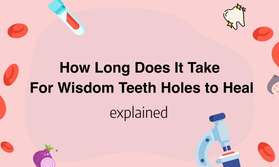 How Long Does It Take For Wisdom Teeth Holes to Heal