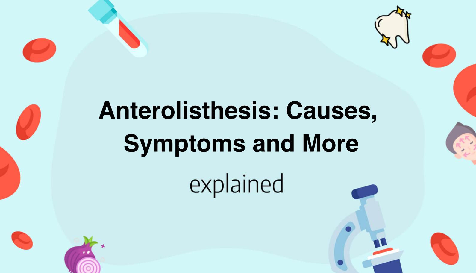 Anterolisthesis: Causes, Symptoms And More