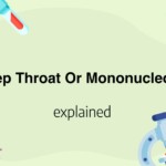 Strep Throat Or Mononucleosis