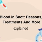 Blood in Snot: Reasons, Treatments And More