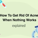 How To Get Rid Of Acne When Nothing Works