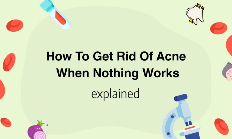 How To Get Rid Of Acne When Nothing Works