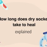 How long does dry socket take to heal