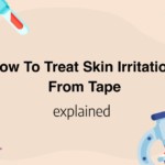 How To Treat Skin Irritation From Tape