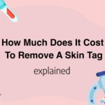 How Much Does It Cost To Remove A Skin Tag