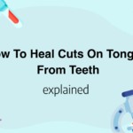 How To Heal Cuts On Tongue From Teeth
