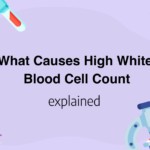 What Causes High White Blood Cell Count
