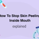 How To Stop Skin Peeling Inside Mouth