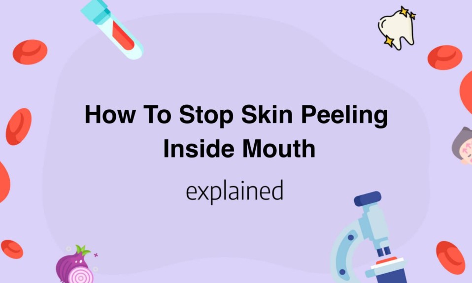 How To Stop Skin Peeling Inside Mouth