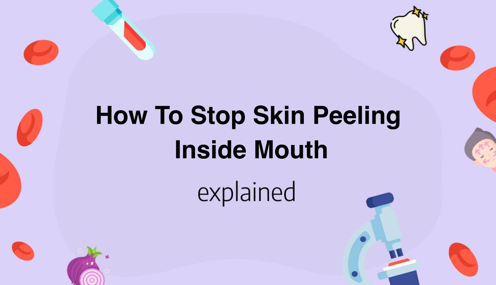 How To Stop Skin Peeling Inside Mouth