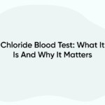 Chloride Blood Test: What It Is And Why It Matters