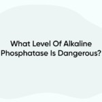 What Level Of Alkaline Phosphatase Is Dangerous?