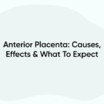 Anterior Placenta: Causes, Effects & What To Expect