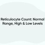Reticulocyte Count: Normal Range, High & Low Levels