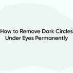 How to Remove Dark Circles Under Eyes Permanently