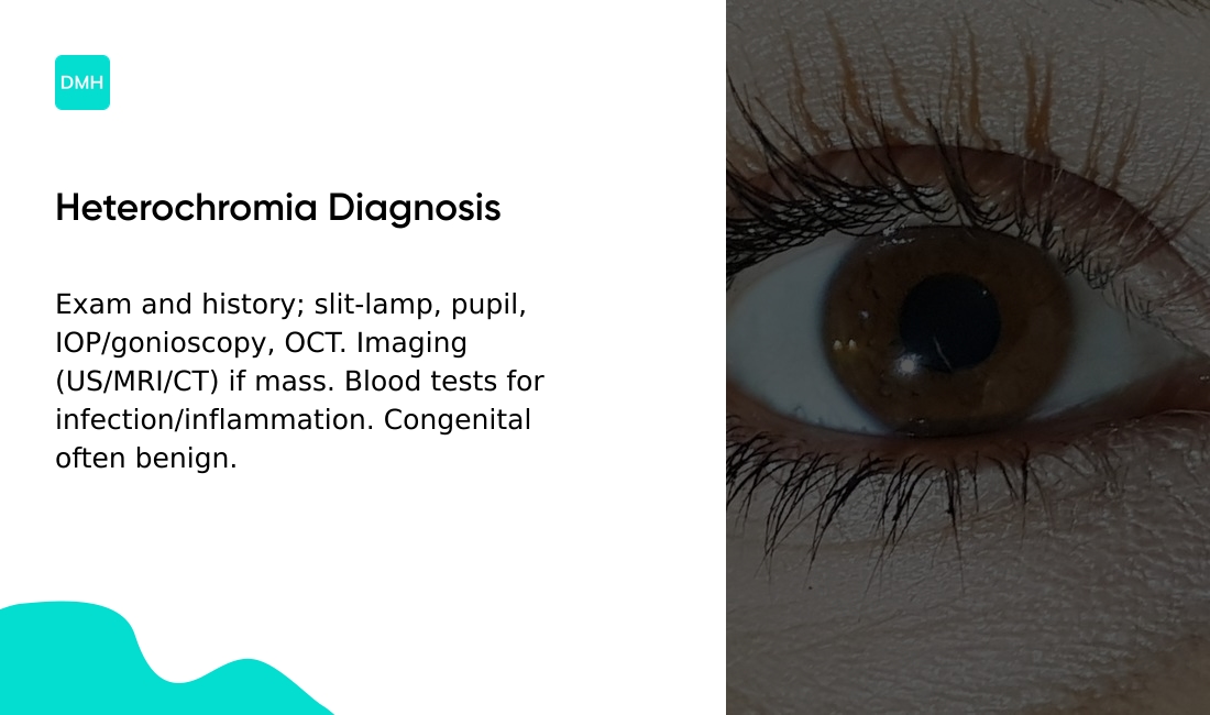 How is heterochromia diagnosed?