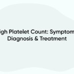 High Platelet Count: Symptoms, Diagnosis & Treatment