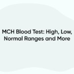 MCH Blood Test: High, Low, Normal Ranges and More