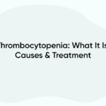 Thrombocytopenia: What It Is, Causes & Treatment